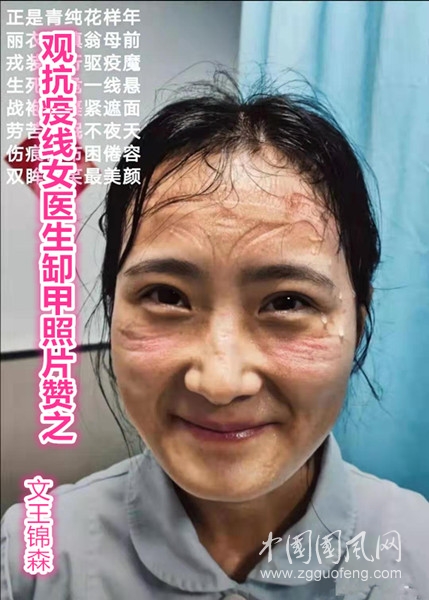  觀抗疫一線女醫(yī)生缷甲照片贊之